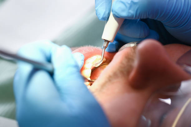 Best Mobile Emergency Dentist in Herricks, NY