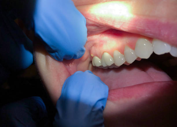 Best Emergency Dental Services for Seniors in Herricks, NY